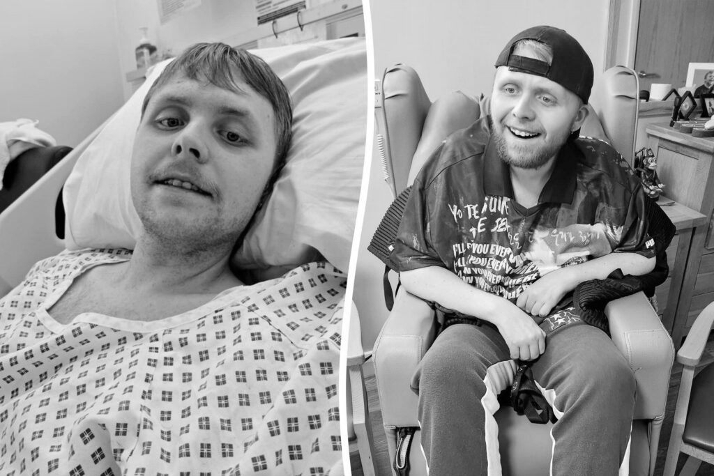 Dementia at 24: UK’s youngest sufferer could unlock clues for future research