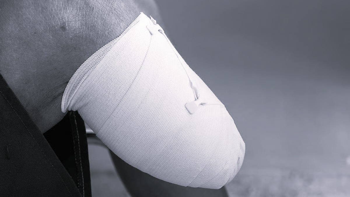 UP youth amputates foot to claim disability quota for MBBS seat