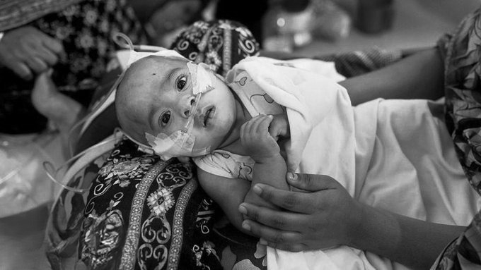 Bangladesh launches emergency measles vaccination after 100 child deaths