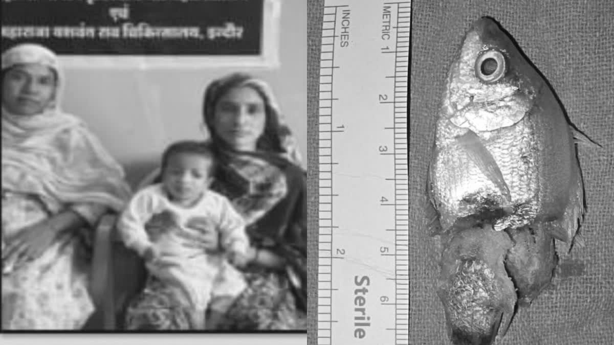 Live fish lodges in one-year-old’s throat during aquarium cleaning, removed after surgery