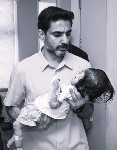 Public Donations, AP Government Help Fund ₹16 Crore SMA Injection for Infant Punervika