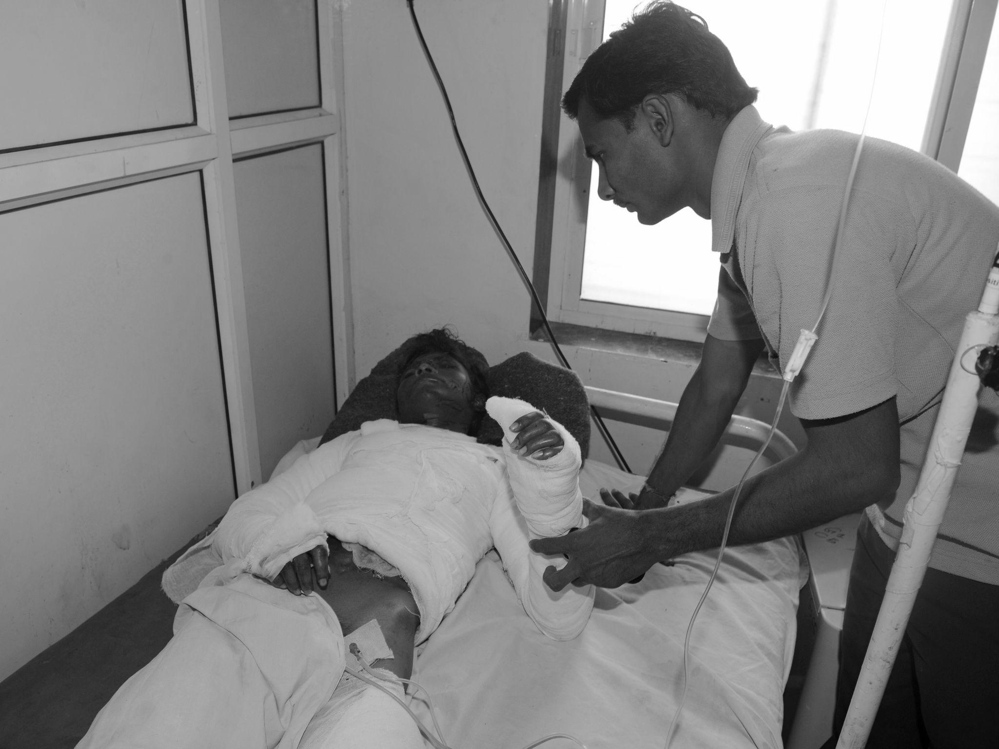 Skin Donation Crisis Deepens in India as Burn Patients Face Critical Shortage