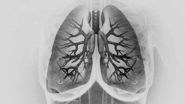Rare Lung Transplant Gives Faridabad Woman a Second Life Amid India’s Organ Shortage
