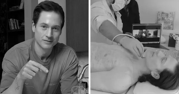 My Stomach Is Eating Itself: Biohacker Bryan Johnson Diagnosed With Incurable Autoimmune Gastritis